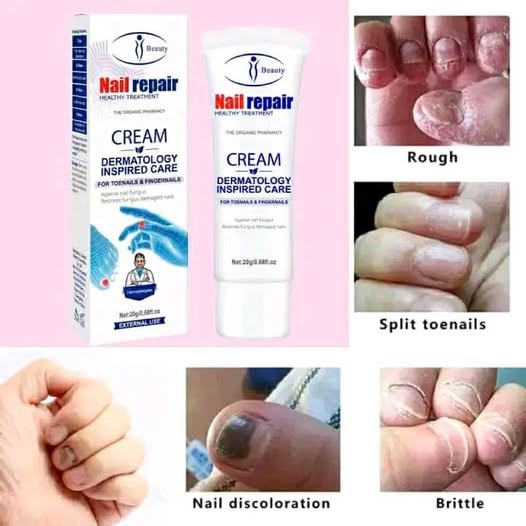 PureNail™ - Anti Hongos