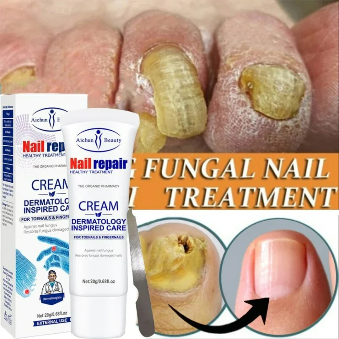 PureNail™ - Anti Hongos